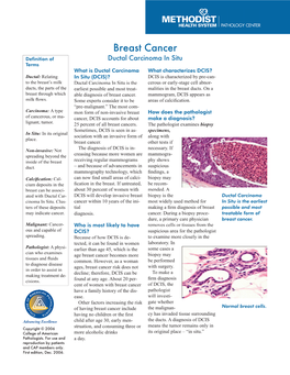 Ductal Carcinoma in Situ