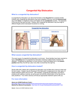 Congenital Hip Dislocation