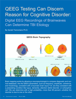 QEEG Testing Can Discern Reason for Cognitive Disorder: Digital EEG Recordings of Brainwaves Can Determine TBI Etiology