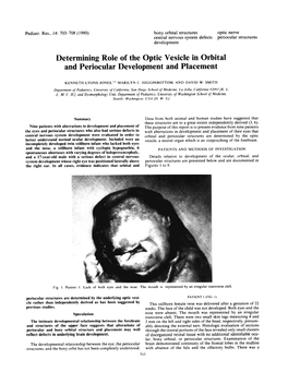 Determining Role of the Optic Vesicle in Orbital and Periocular Development and Placement