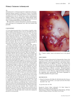 Primary Cutaneous Actinomycosis