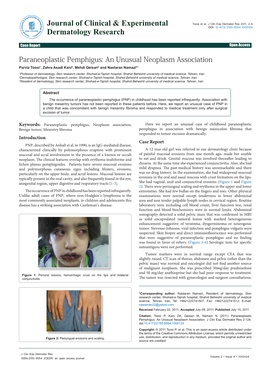 Paraneoplastic Pemphigus: an Unusual Neoplasm Association