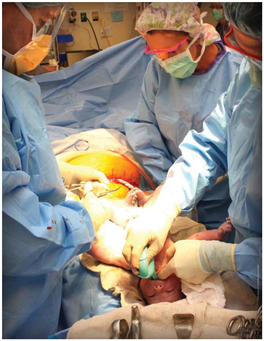 The Modern-Day C-Section