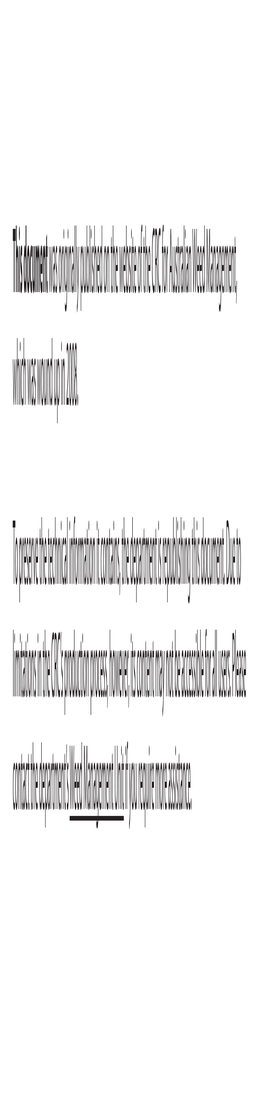 Update on Leaf-Feeding Willow Sawfly: the Arrival of Nematus Oligospilus in Australia