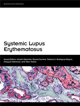 Systemic Lupus Erythematosus