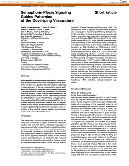 Short Article Semaphorin-Plexin Signaling Guides Patterning of The