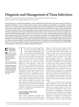 Diagnosis and Management of Tinea Infections JOHN W