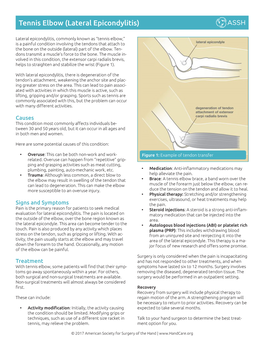 Tennis Elbow (Lateral Epicondylitis)