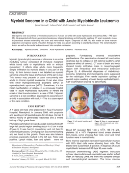 Myeloid Sarcoma in a Child with Acute Myeloblastic Leukaemia Jamal Ahmad1, Lubna Zafar1, Gul Hussain2 and Sajida Kausar3