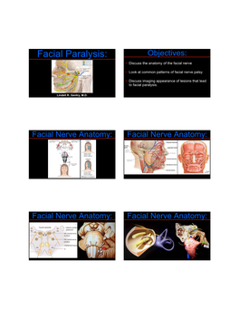 Facial Paralysis: Objectives: • Discuss the Anatomy of the Facial Nerve