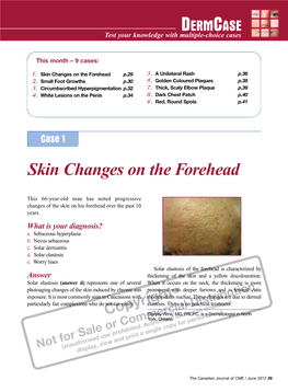 Skin Changes on the Forehead P.29 5