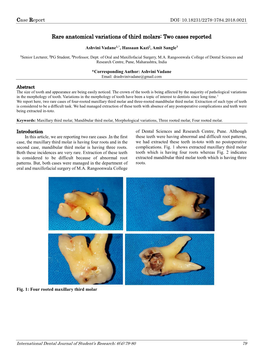 Rare Anatomical Variations of Third Molars: Two Cases Reported