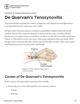 De Quervain's Tenosynovitis