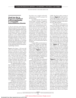 Visual Loss Due to Progressive Multifocal Leukoencephalopathy In