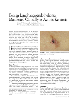 Benign Lymphangioendothelioma Manifested Clinically As Actinic Keratosis James A