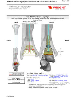 Implant Information