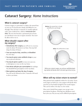 Cataract Surgery: Home Instructions