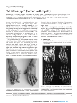 “Mutilans-Type” Jaccoud Arthropathy