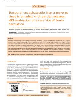 Temporal Encephalocele Into Transverse Sinus in an Adult with Partial Seizures