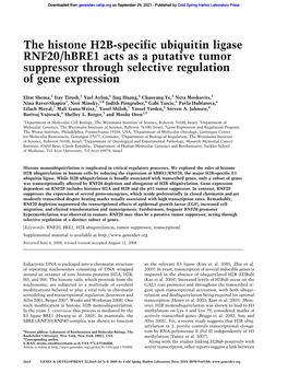 The Histone H2B-Specific Ubiquitin Ligase RNF20/Hbre1 Acts As a Putative Tumor Suppressor Through Selective Regulation of Gene Expression