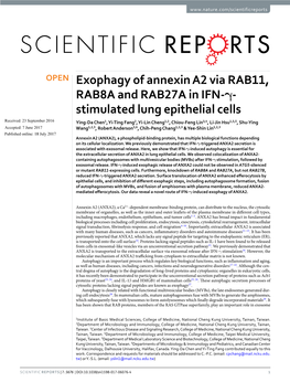 Exophagy of Annexin A2 Via RAB11, RAB8A and RAB27A in IFN-Γ