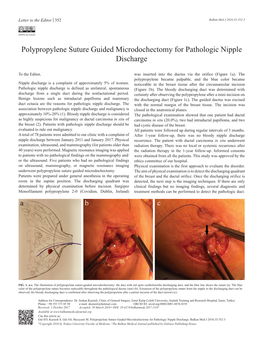 Polypropylene Suture Guided Microdochectomy for Pathologic Nipple Discharge