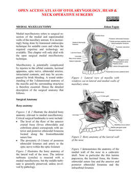 MEDIAL MAXILLECTOMY Johan Fagan