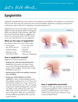 Epiglottitis