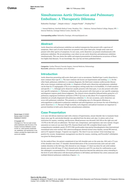 Simultaneous Aortic Dissection and Pulmonary Embolism: a Therapeutic Dilemma