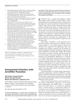 Unexpected Infection with Armillifer Parasites