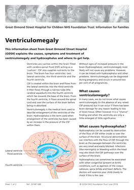 Ventriculomegaly