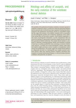 Histology and Affinity of Anaspids, and the Early Evolution of the Vertebrate