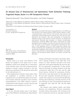 An Unusual Case of Osteonecrosis and Spontaneous Tooth Exfoliation Following