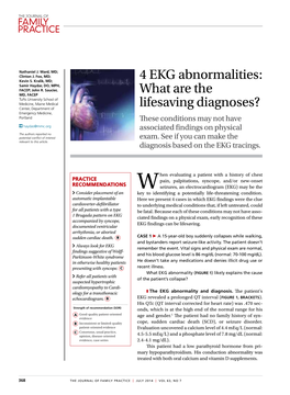 4 EKG Abnormalities: What Are the Lifesaving Diagnoses?