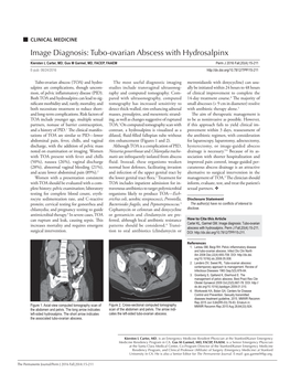 Tubo-Ovarian Abscess with Hydrosalpinx
