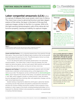 Leber Congenital Amaurosis (LCA) Refers WHAT IS the RETINA? to a Group of Diseases That Cause Severe Vision Loss in Infancy