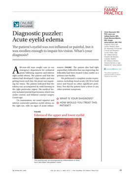 Diagnostic Puzzler: Acute Eyelid Edema