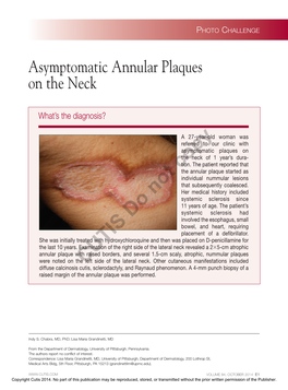 Asymptomatic Annular Plaques on the Neck