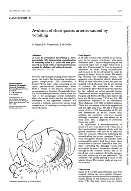 Avulsion of Short Gastric Arteries Caused by Vomiting