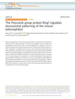 The Polycomb Group Protein Ring1 Regulates Dorsoventral Patterning Of