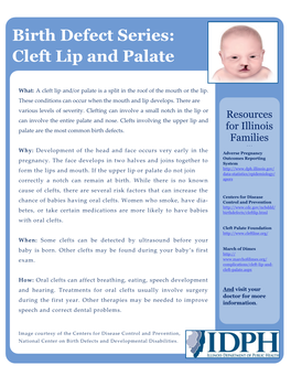 Cleft Lip and Palate