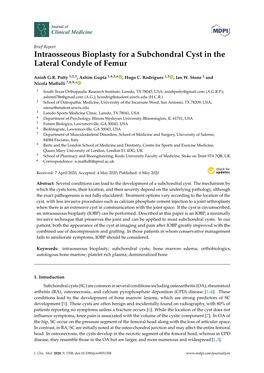 Intraosseous Bioplasty for a Subchondral Cyst in the Lateral Condyle of Femur