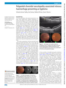 Polypoidal Choroidal Vasculopathy-Associated Vitreous Haemorrhage Presenting As Hyphema Srikanta Kumar Padhy, Atul Kumar, Rebika Dhiman, Karen Sharma