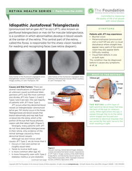 Idiopathic Juxtafoveal Telangiectasis