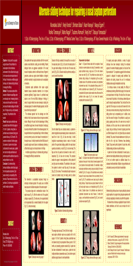 Alternate Sliding Technique for Repairing a Nasal Septum Perforation
