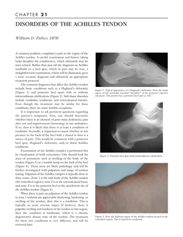 Disorders of the Achilles Tendon