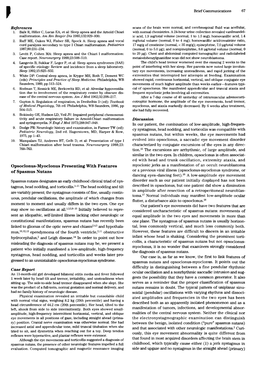 Opsoclonus-Myoclonus Presenting with Features of Spasmus Nutans