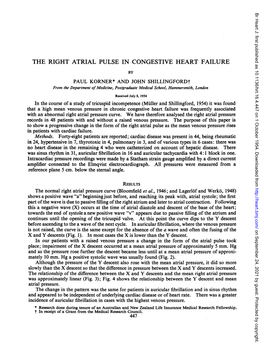 The Right Atrial Pulse in Congestive Heart Failure