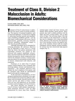 Treatment of Class II, Division 2 Malocclusion in Adults: Biomechanical Considerations