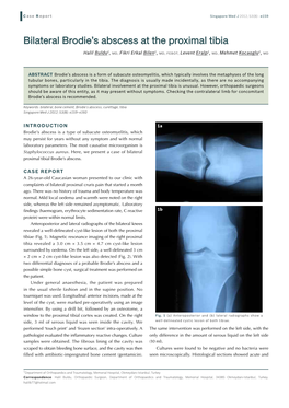 Bilateral Brodie's Abscess at the Proximal Tibia